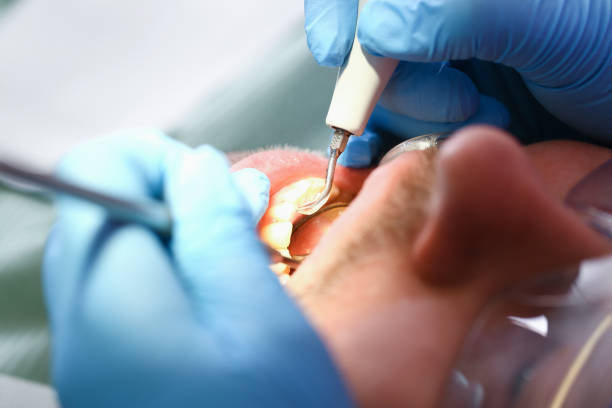 Best Dentist for Tooth Abscess  in Black Point Green Point, CA