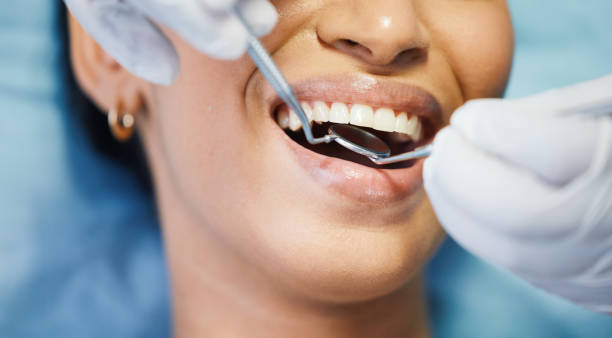 Best Root Canal Emergency Dentist  in Black Point Green Point, CA